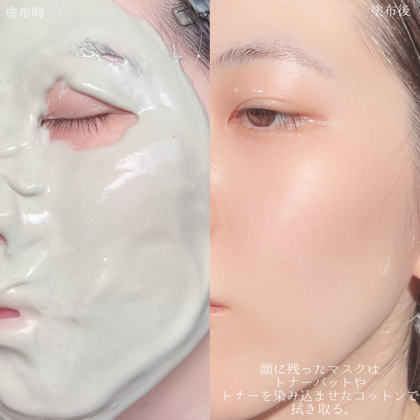 モデリングパック ドクダミ/ONE THING/シートマスク・パックを使ったクチコミ(8枚目)