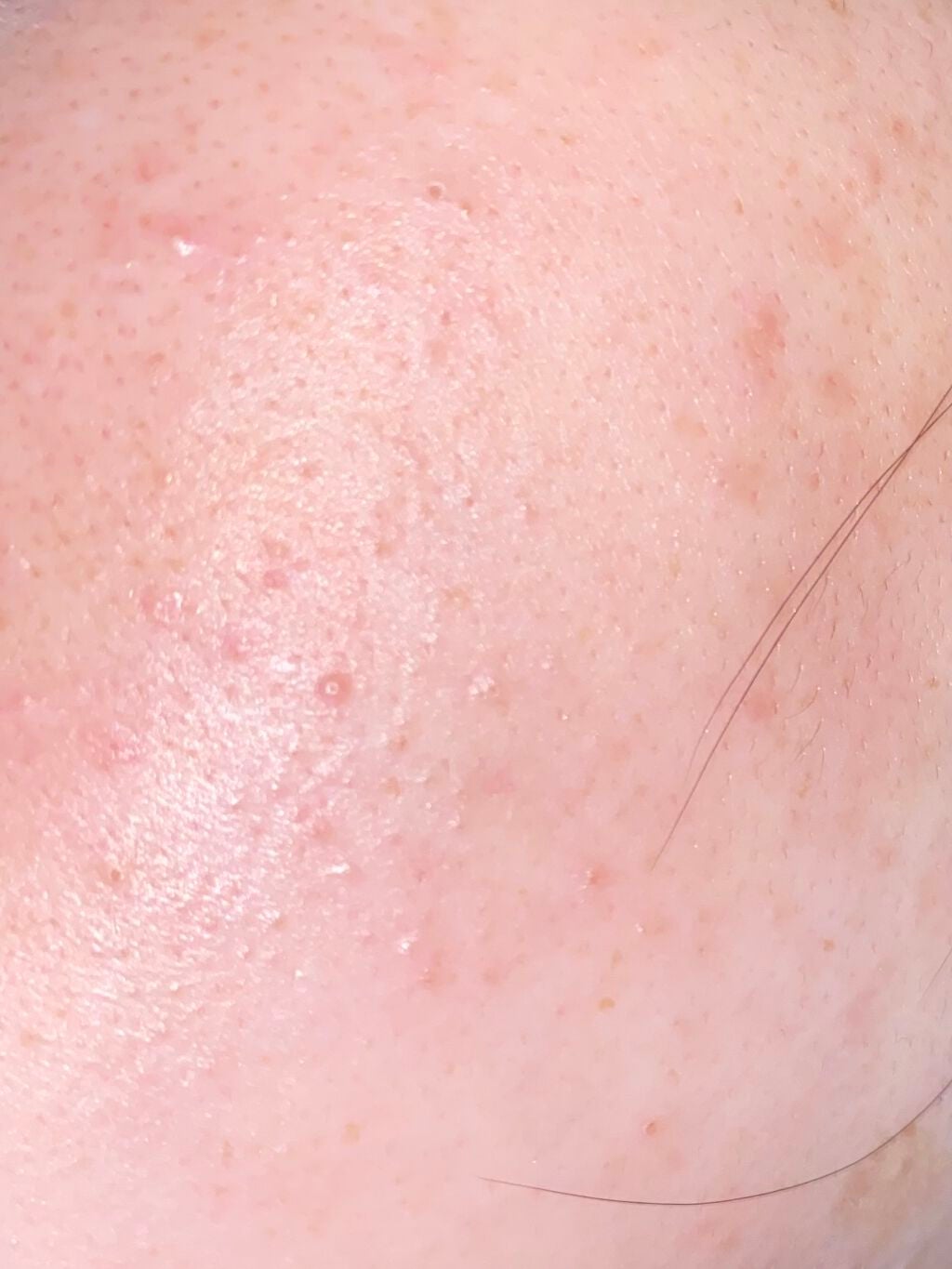 ビビ on LIPS 「顔面記録9日目昨日の更新出来ずサボった感が出てしまって申し訳な..」(2枚目)