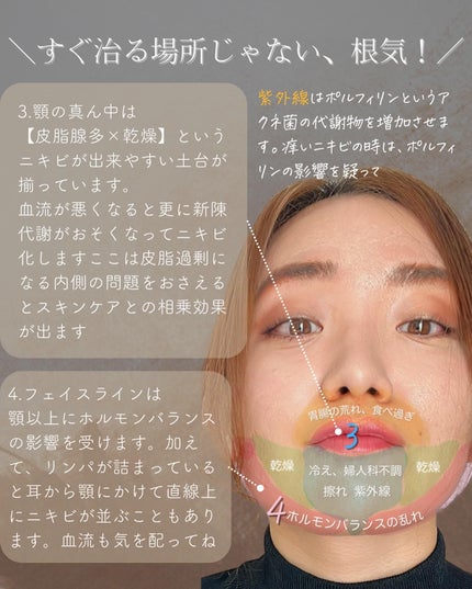 おゆみ|ニキビ・ニキビ跡ケア on LIPS 「@______ohyoume 他の投稿はこちらから👋✨こんばん..」(4枚目)