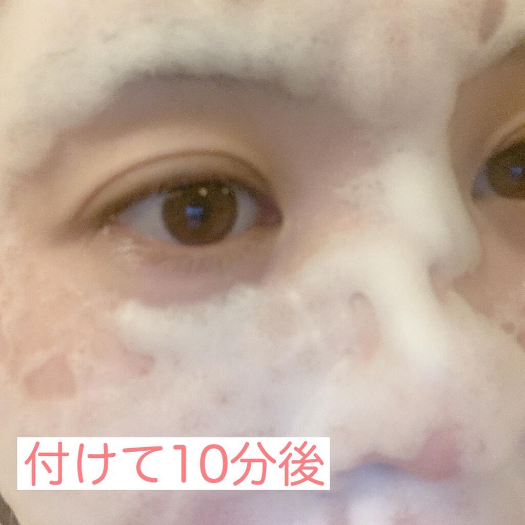 PHスプラッシュマスクPro./ビービーラボラトリーズ/洗い流すパック・マスクを使ったクチコミ(5枚目)