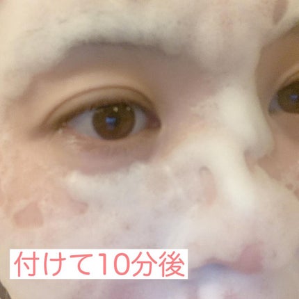 PHスプラッシュマスクPro./ビービーラボラトリーズ/洗い流すパック・マスクを使ったクチコミ(5枚目)