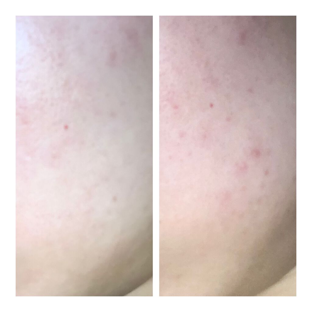 スキンメインテナイザー S/リサージ/化粧水を使ったクチコミ(1枚目)