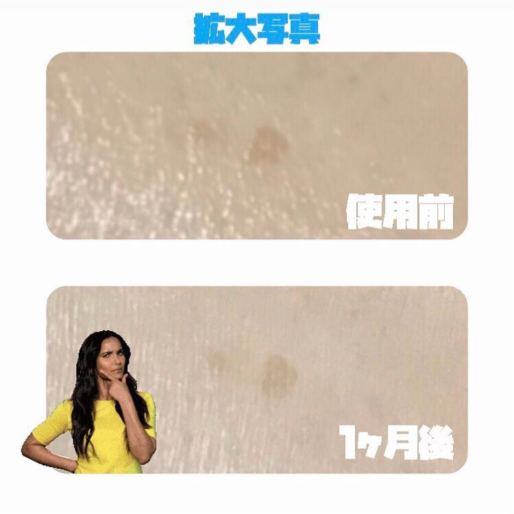 AK【韓コス多め】 on LIPS 「🍎ドクタージャルトV7ビタレーザー2.1🍎*インスタの過..」(4枚目)