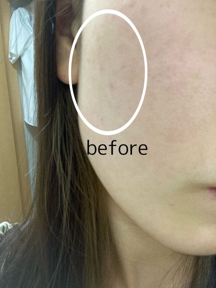 カバーパーフェクション チップコンシーラー/the SAEM/リキッドコンシーラーを使ったクチコミ(2枚目)