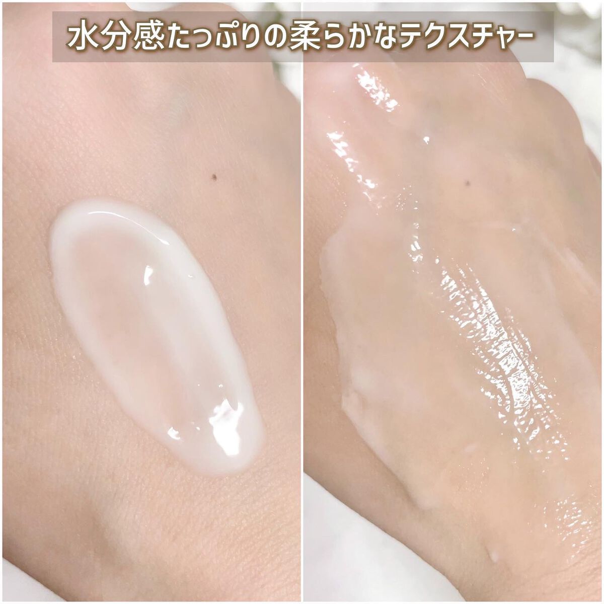 シカレチA エッセンス0.1/VT/美容液を使ったクチコミ(5枚目)