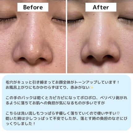 ゼロ毛穴パッド 2.0/MEDICUBE/トナーパッドを使ったクチコミ(8枚目)
