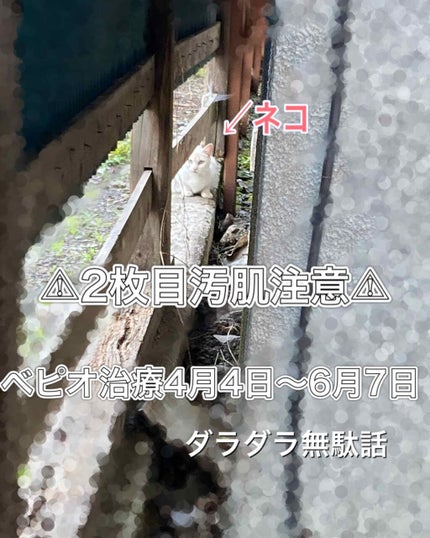 ロゼット洗顔パスタ 海泥スムース/ロゼット/洗顔フォームを使ったクチコミ(1枚目)