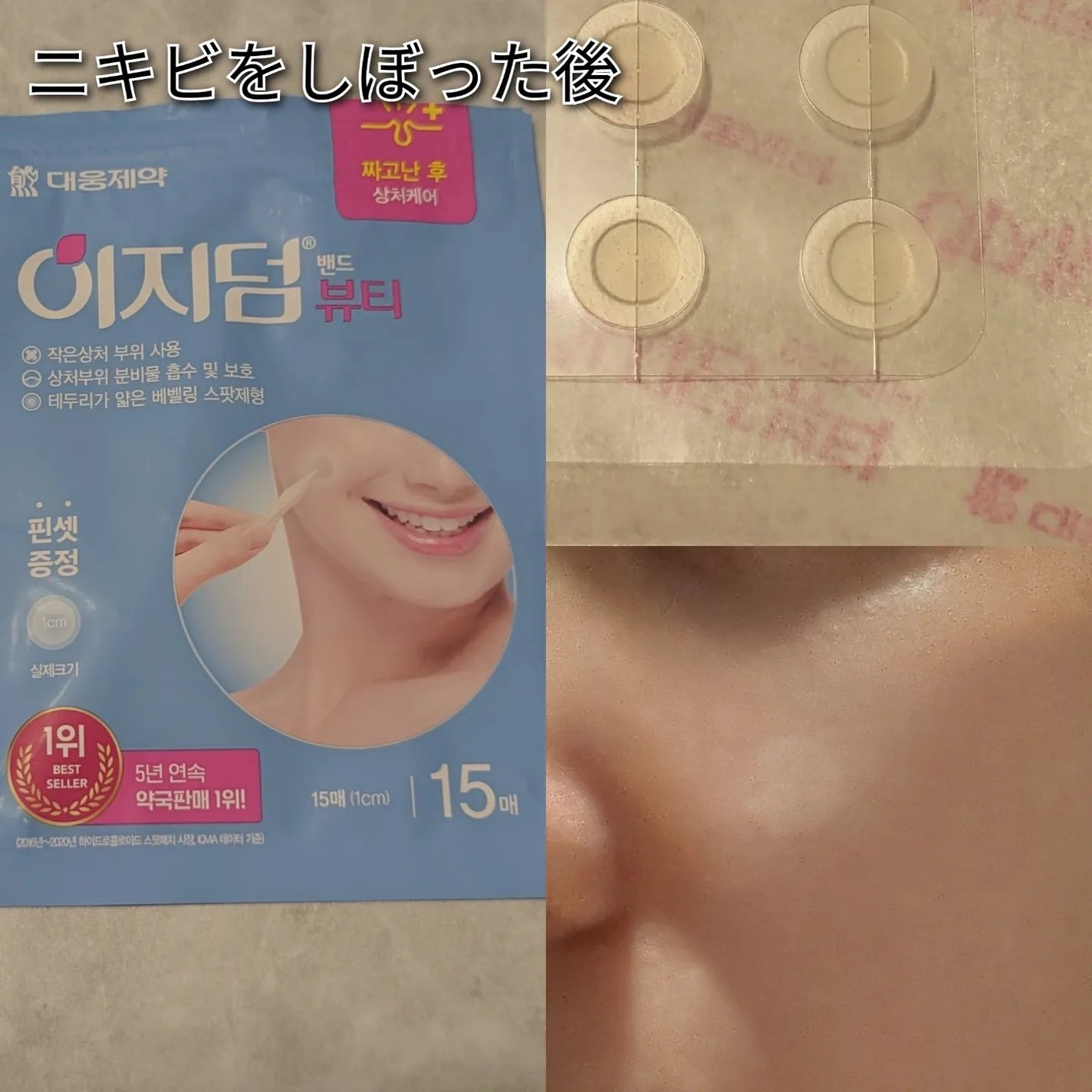 ビューティー スポットパッチ/イージーダムビューティー/にきびパッチを使ったクチコミ(2枚目)