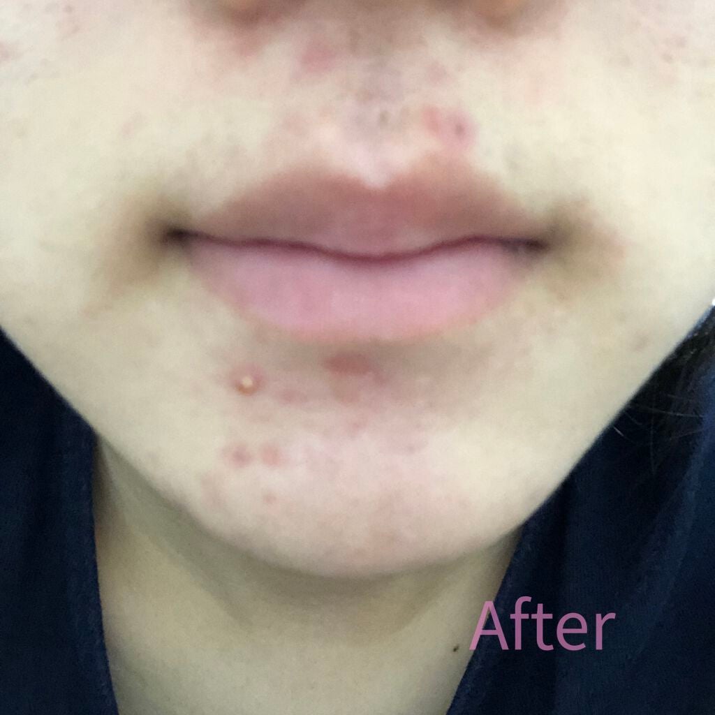 ハトムギ化粧水(ナチュリエ スキンコンディショナー R )/ナチュリエ/化粧水を使ったクチコミ(4枚目)