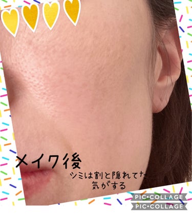 sato on LIPS 「40代、私の肌悩みはたるみ毛穴と目元の小ジワ、シミ😭ファンデー..」（3枚目）