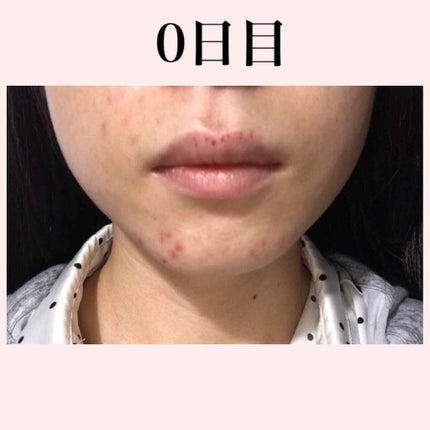 ファイバーフォーム/ルナメアAC/洗顔フォームを使ったクチコミ(2枚目)