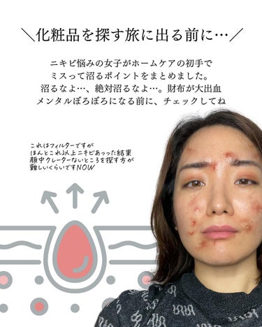 おゆみ|ニキビ・ニキビ跡ケア on LIPS 「【ニキビ歴２０年の私が、最初に知っておきたかったこと】✔︎ニキ..」（2枚目）