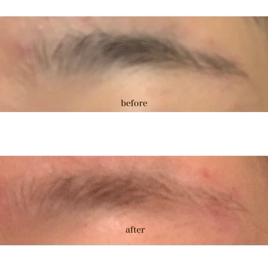 除毛クリームキット敏感肌用/エピラット/除毛クリームを使ったクチコミ(3枚目)