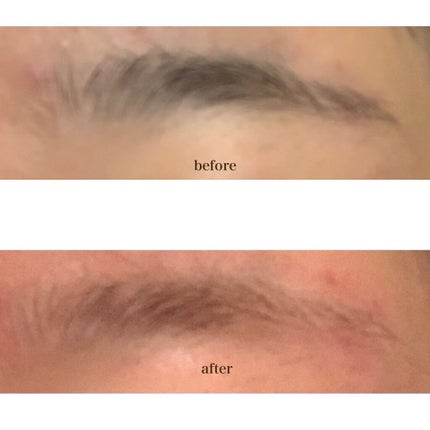 除毛クリームキット敏感肌用/エピラット/除毛クリームを使ったクチコミ(3枚目)