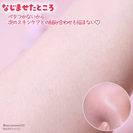 DETクリア ブライト&ピール ピール美容液/Detclear/美容液を使ったクチコミ(4枚目)