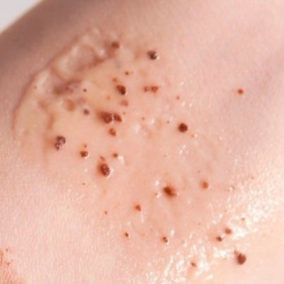 角質スッキリ毛穴パック /HANYUL(ハンユル)/洗い流すパック・マスクを使ったクチコミ(4枚目)