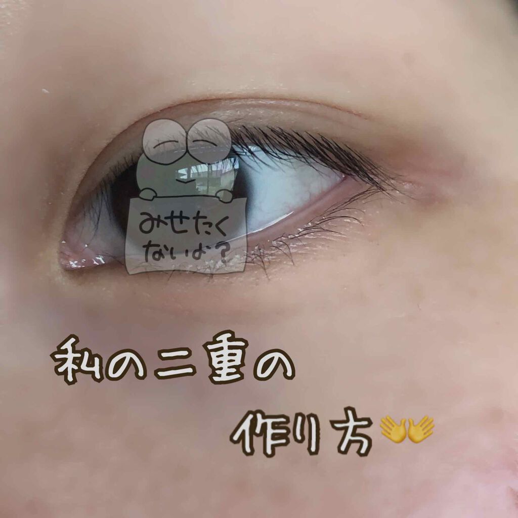アクティブアイトークII/アイトーク/二重まぶた用アイテムを使ったクチコミ（1枚目）