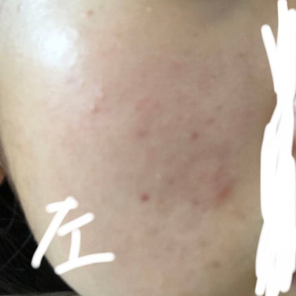 を使ったクチコミ(2枚目)