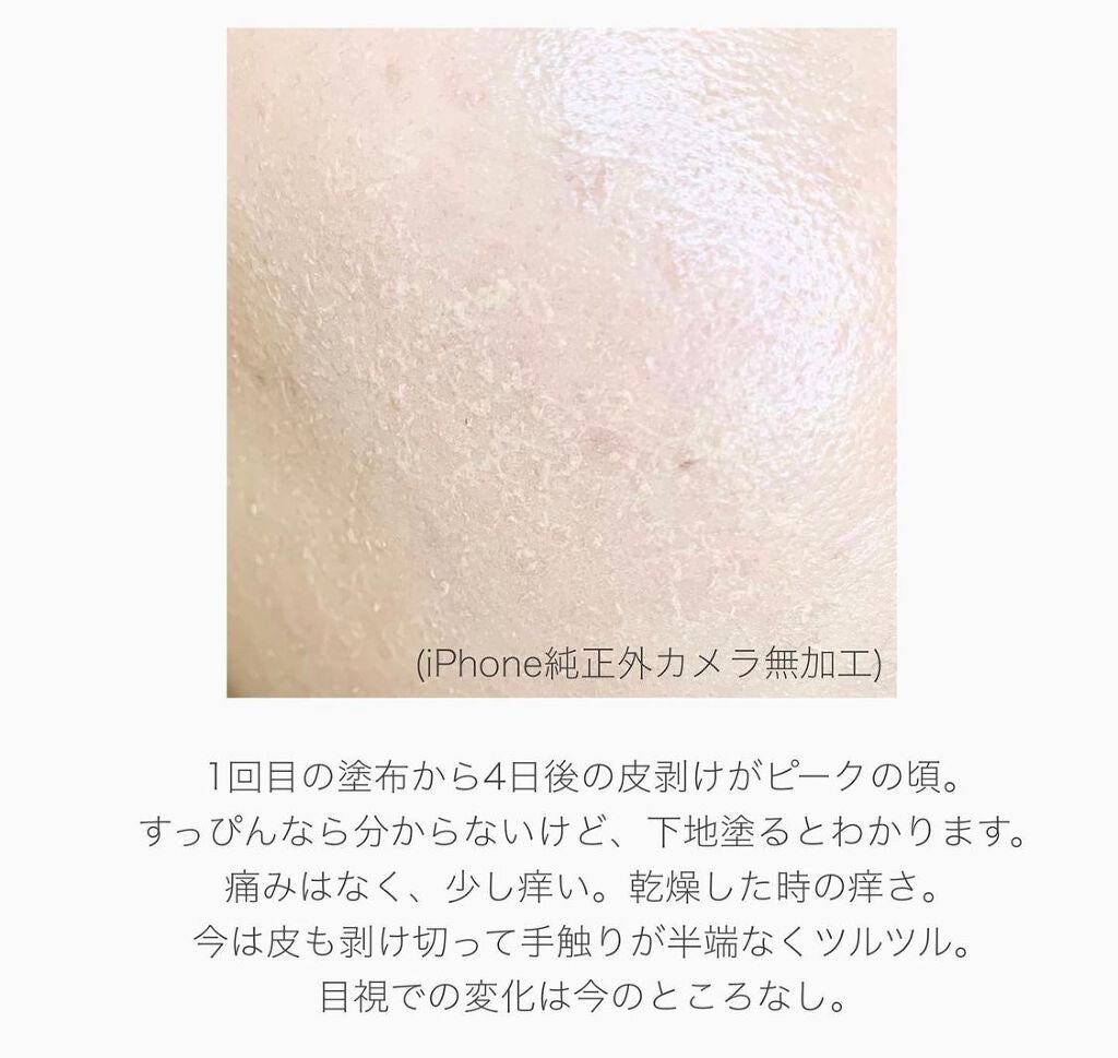 nene_2378 on LIPS 「⚠️)肌のアップ写真あります。スライド注意。【レチノール1..」(3枚目)