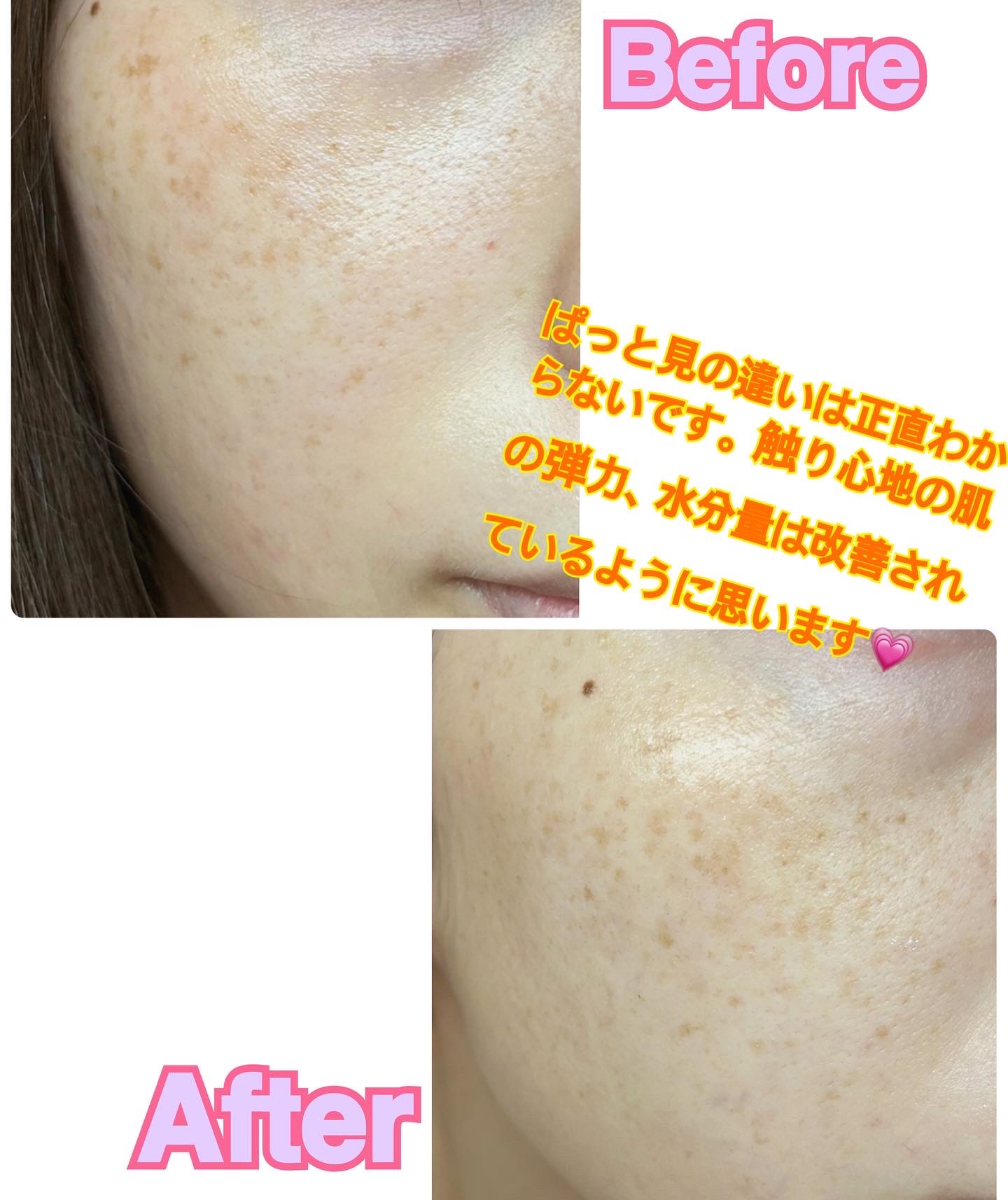 シカバイタル マスク/VT/シートマスク・パックを使ったクチコミ（2枚目）