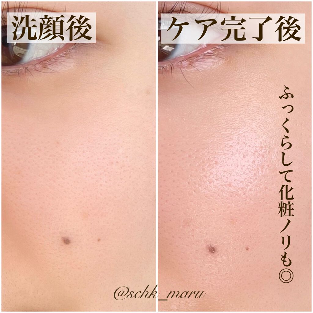 パーフェクト ポア プログラム/LAVIEN/その他スキンケアを使ったクチコミ(9枚目)