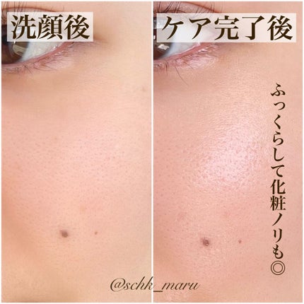 パーフェクト ポア プログラム/LAVIEN/その他スキンケアを使ったクチコミ(9枚目)