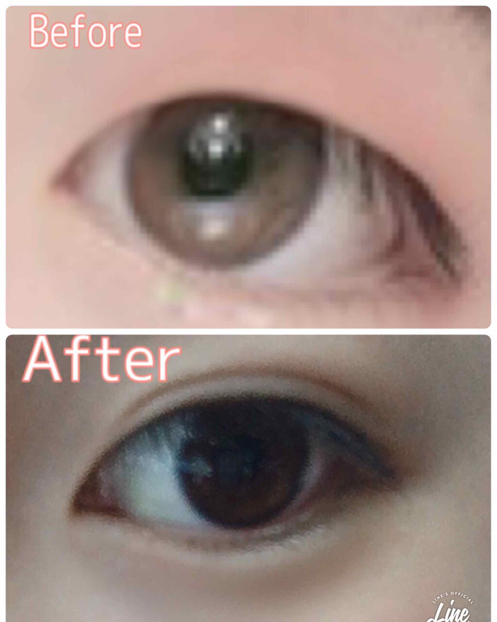 のび〜る アイテープ 両面テープタイプ/DAISO/二重まぶた用アイテムを使ったクチコミ（1枚目）