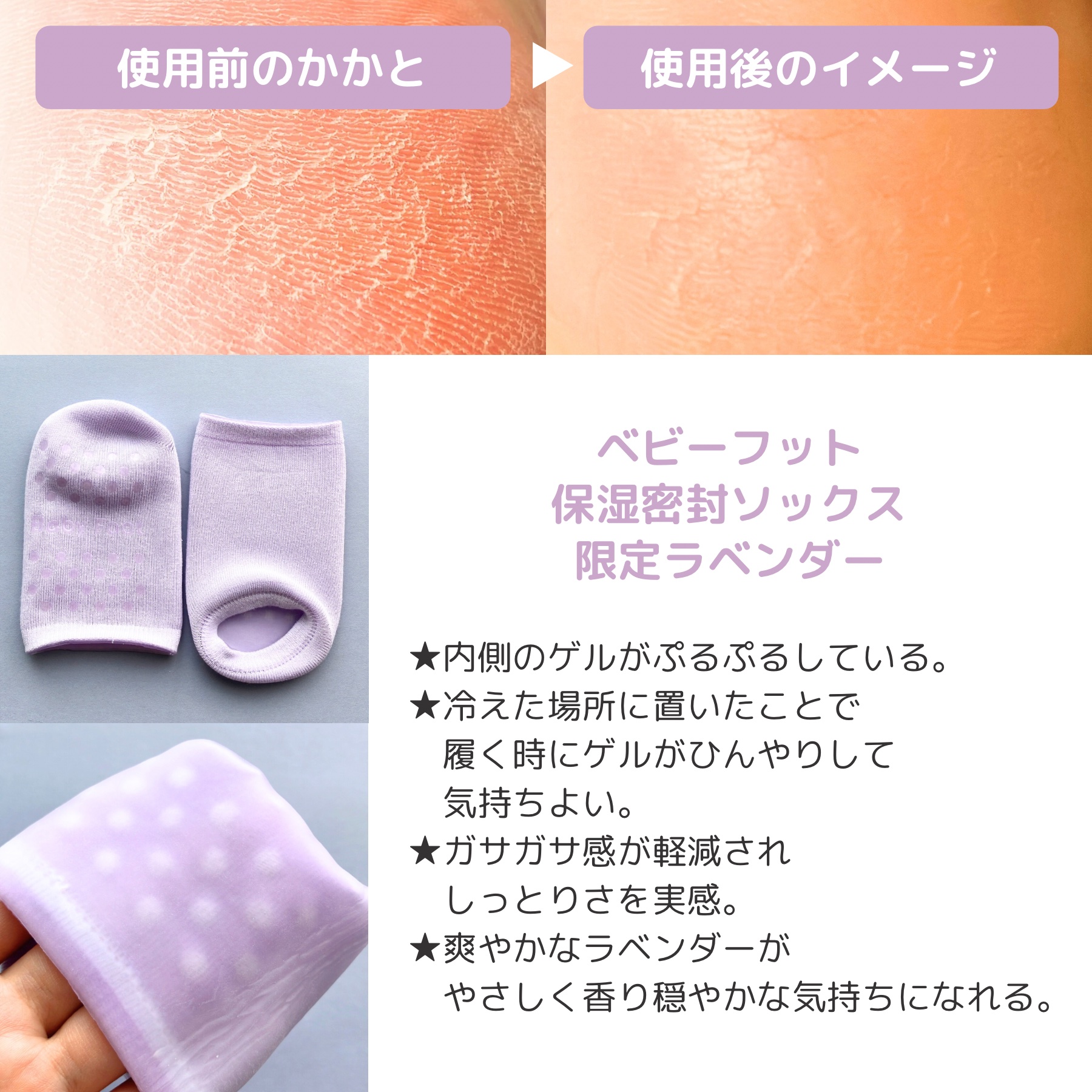 ベビーフット 保湿密封ソックス/ベビーフット/レッグ・フットケアを使ったクチコミ（2枚目）