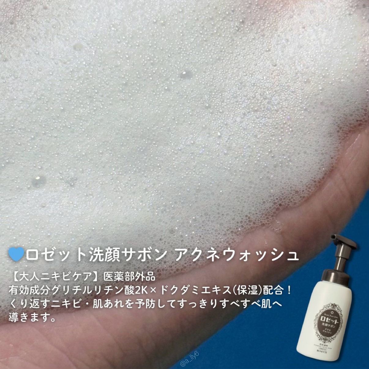 ロゼット洗顔サボン アクネウォッシュ【医薬部外品】[泡洗顔料]/ロゼット/泡洗顔を使ったクチコミ（2枚目）