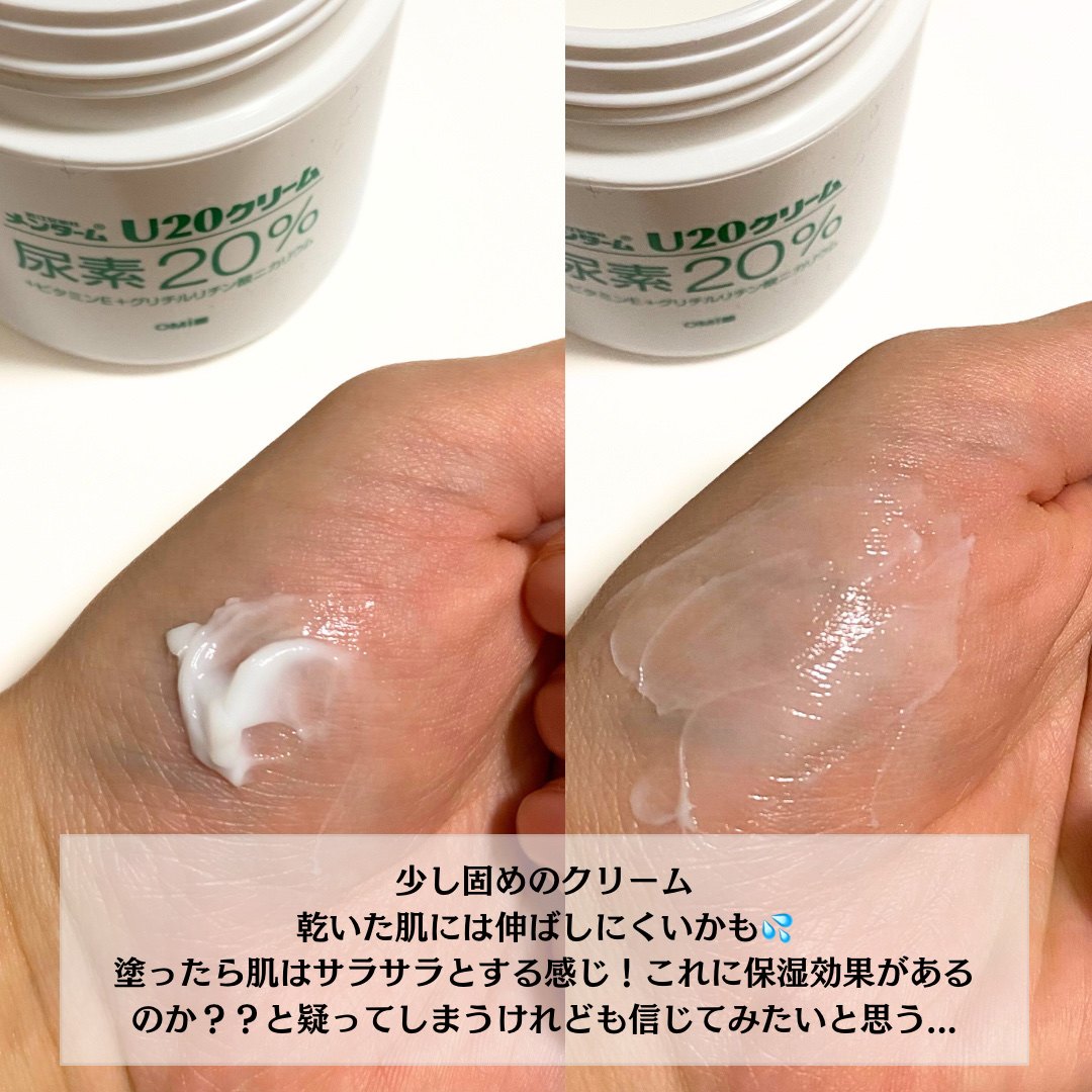U20クリーム(医薬品)/メンターム/その他を使ったクチコミ（2枚目）