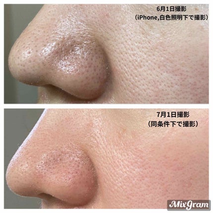 フェイシャル トリートメント エッセンス/SK-II/化粧水を使ったクチコミ(4枚目)