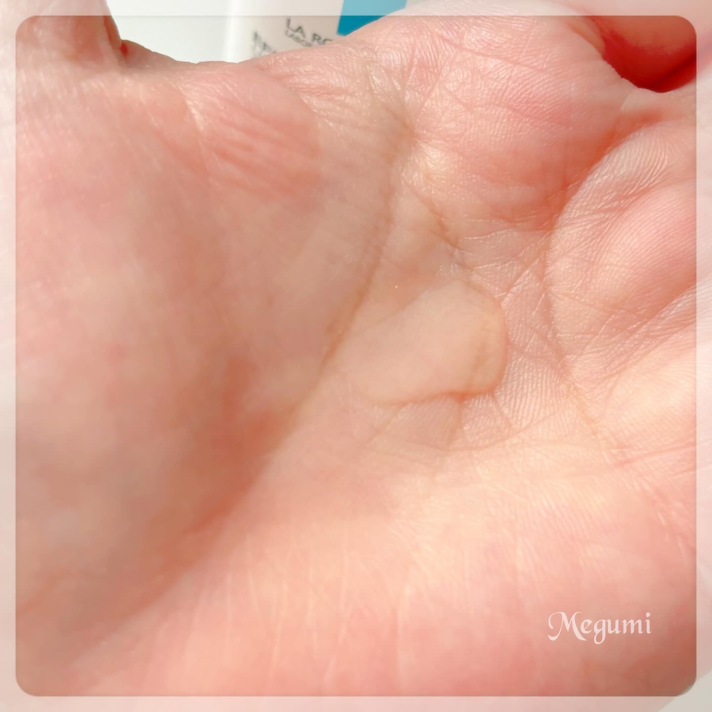 エファクラ ピールケア セラム/ラ ロッシュ ポゼ/美容液を使ったクチコミ（3枚目）