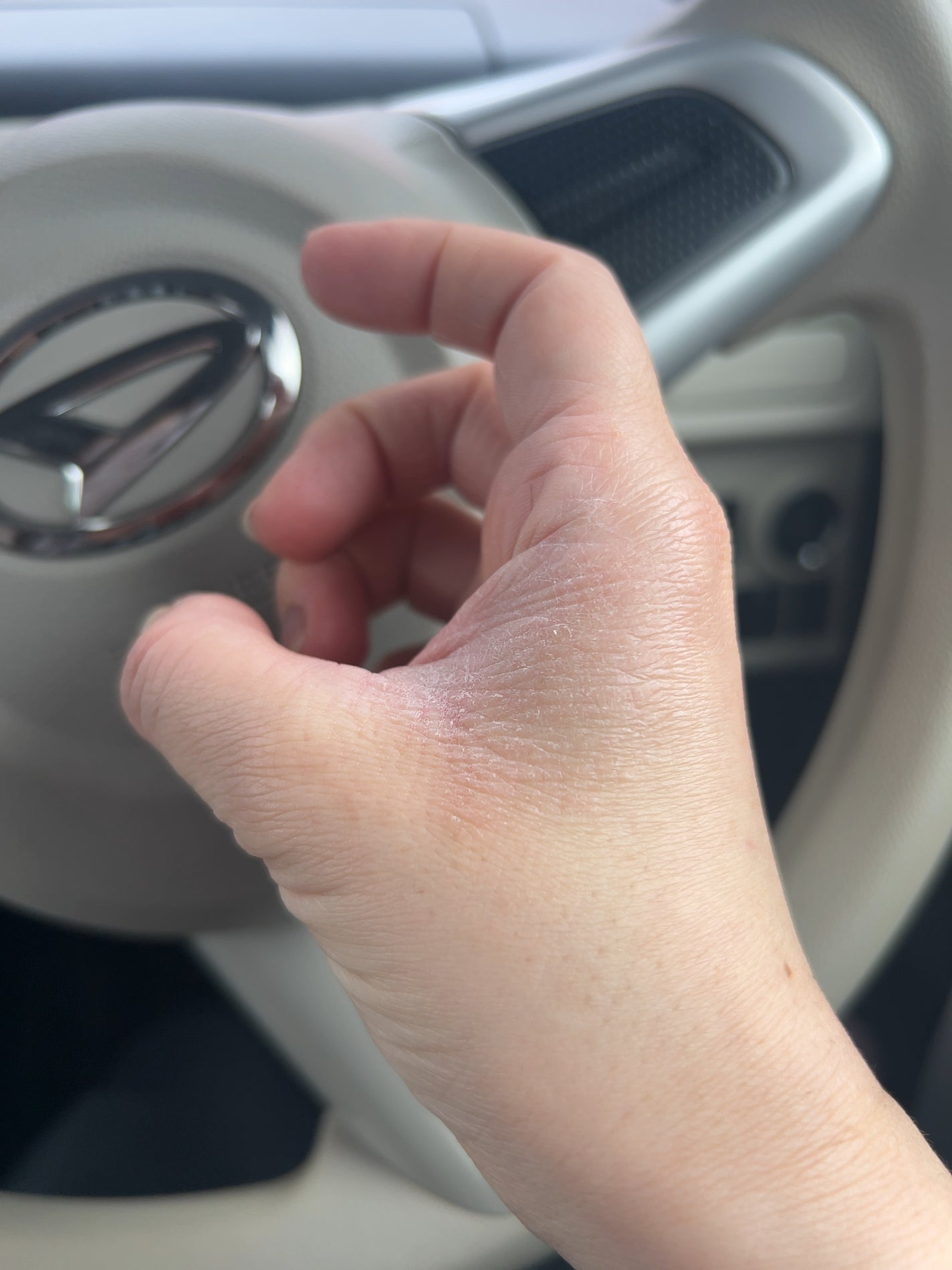 白色ワセリン(医薬品)/健栄製薬/その他を使ったクチコミ(3枚目)