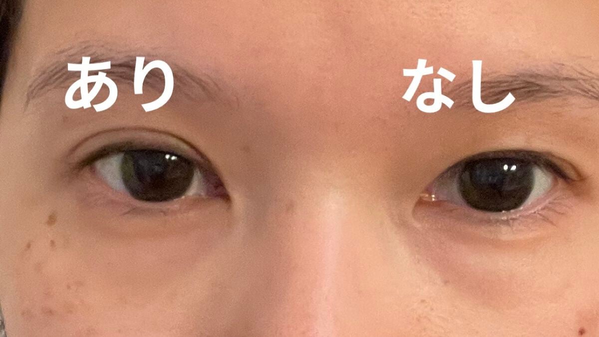 アイビューティー フィクサー WP/アストレア ヴィルゴ/二重まぶた用アイテムを使ったクチコミ(5枚目)