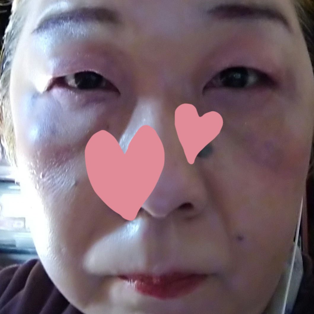 M クッション ファンデーション(プロカバー)/MISSHA/クッションファンデーションを使ったクチコミ（3枚目）