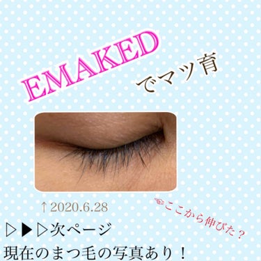 EMAKED（エマーキット）/水橋保寿堂製薬/まつげ美容液を使ったクチコミ（1枚目）