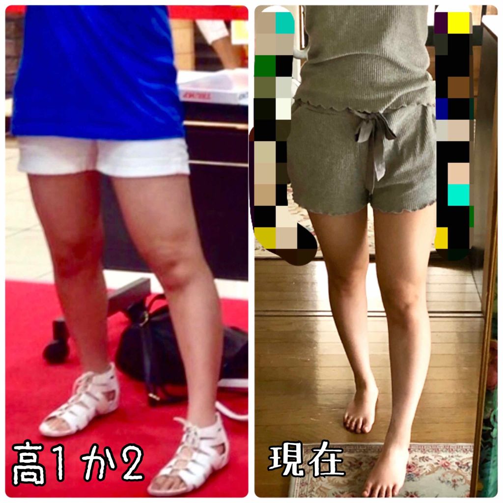 寝ながらメディキュット ロング/メディキュット/着圧ソックス・レギンスを使ったクチコミ（2枚目）