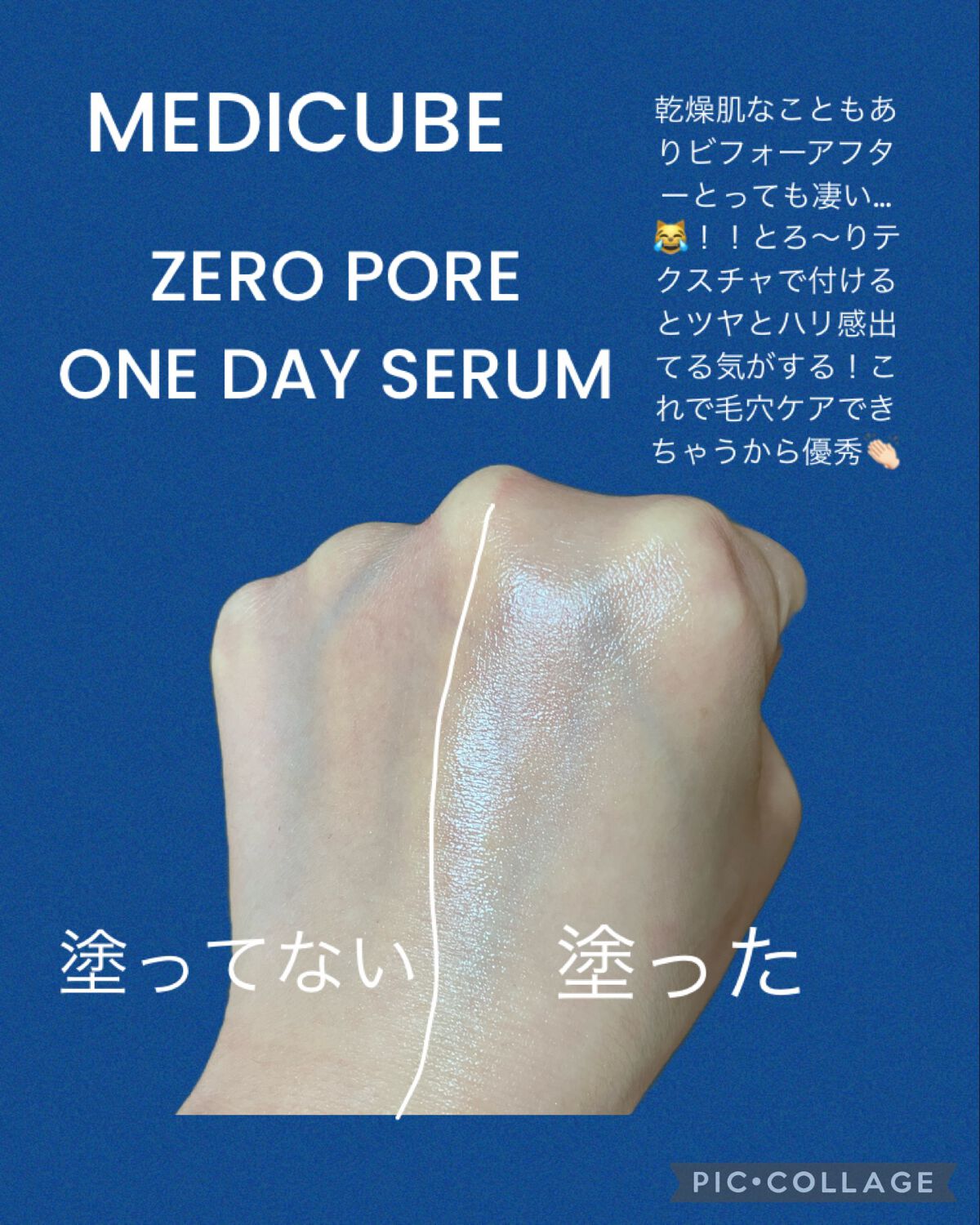 ゼロ毛穴1DAYセラム/MEDICUBE/美容液を使ったクチコミ(1枚目)