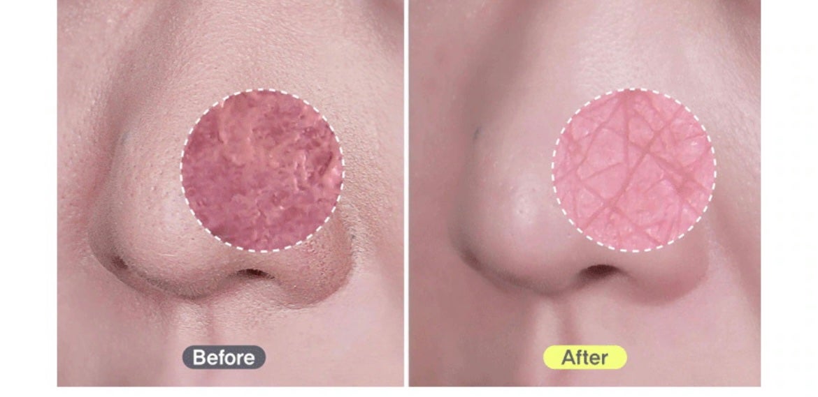 スーパーベジトックスクレンザー イエロー/WONDER BATH/洗顔フォームを使ったクチコミ(6枚目)