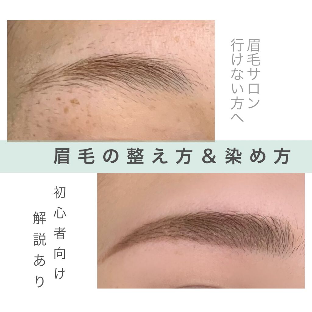 脱色クリーム スピーディー/エピラット/ムダ毛ケアを使ったクチコミ（1枚目）