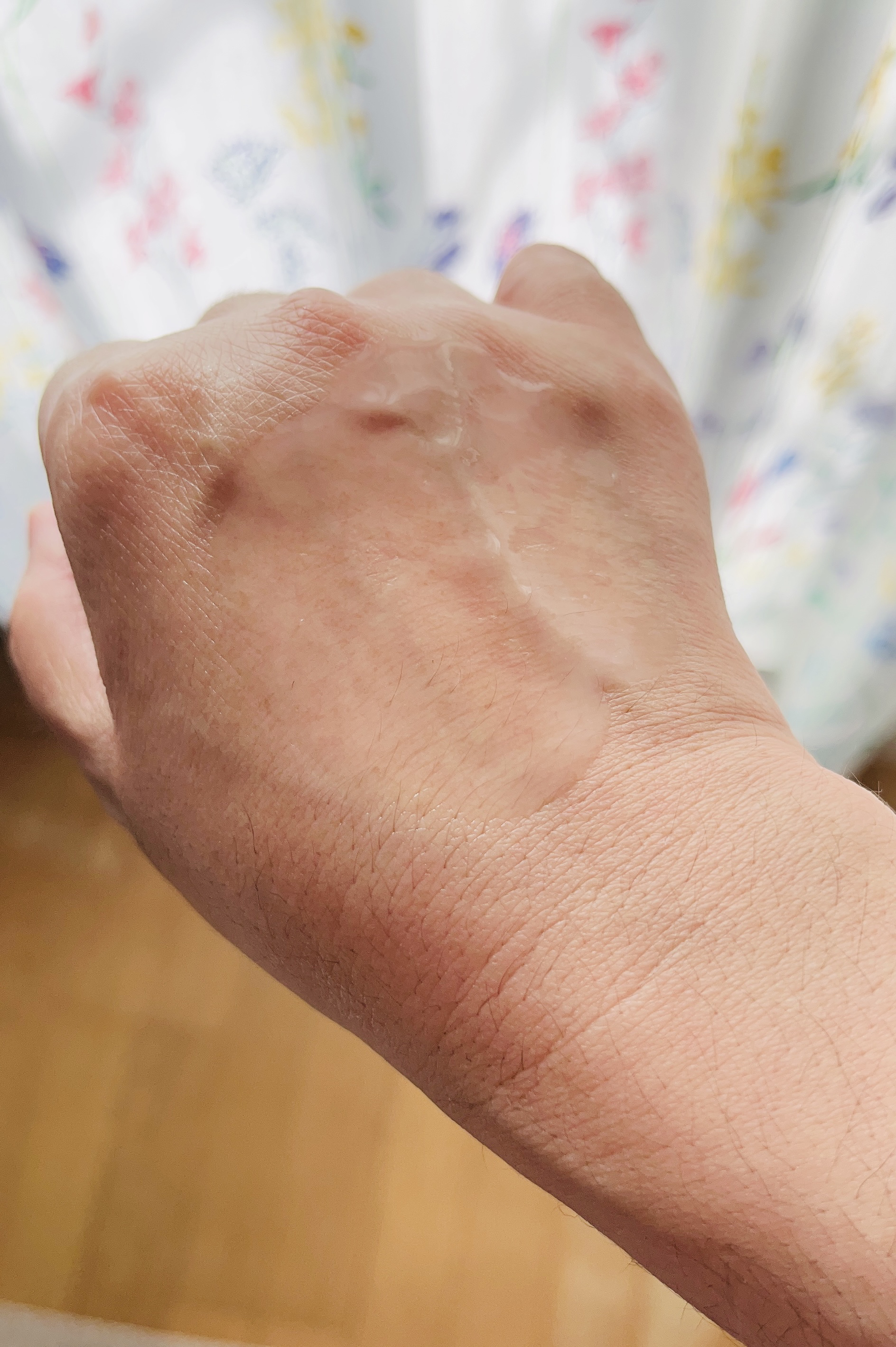 プロバイオシカ インテンシブ アンプル/SKIN1004/美容液を使ったクチコミ（3枚目）