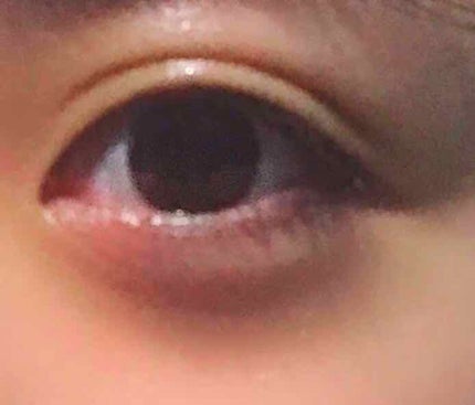 アイトーク 大人のまぶたコントロール/アイトーク/二重まぶた用アイテムを使ったクチコミ(3枚目)