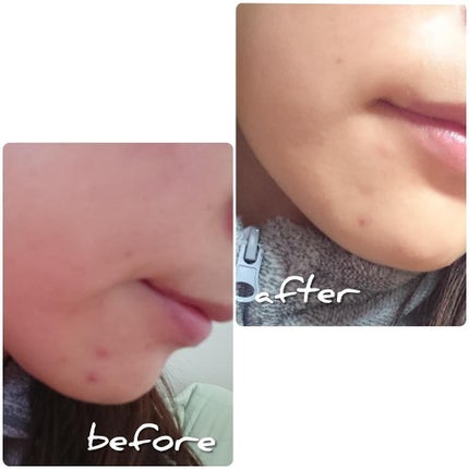 ミラクプロフェッショナル8315/ミラクルプロフェッショナル/化粧水を使ったクチコミ(3枚目)