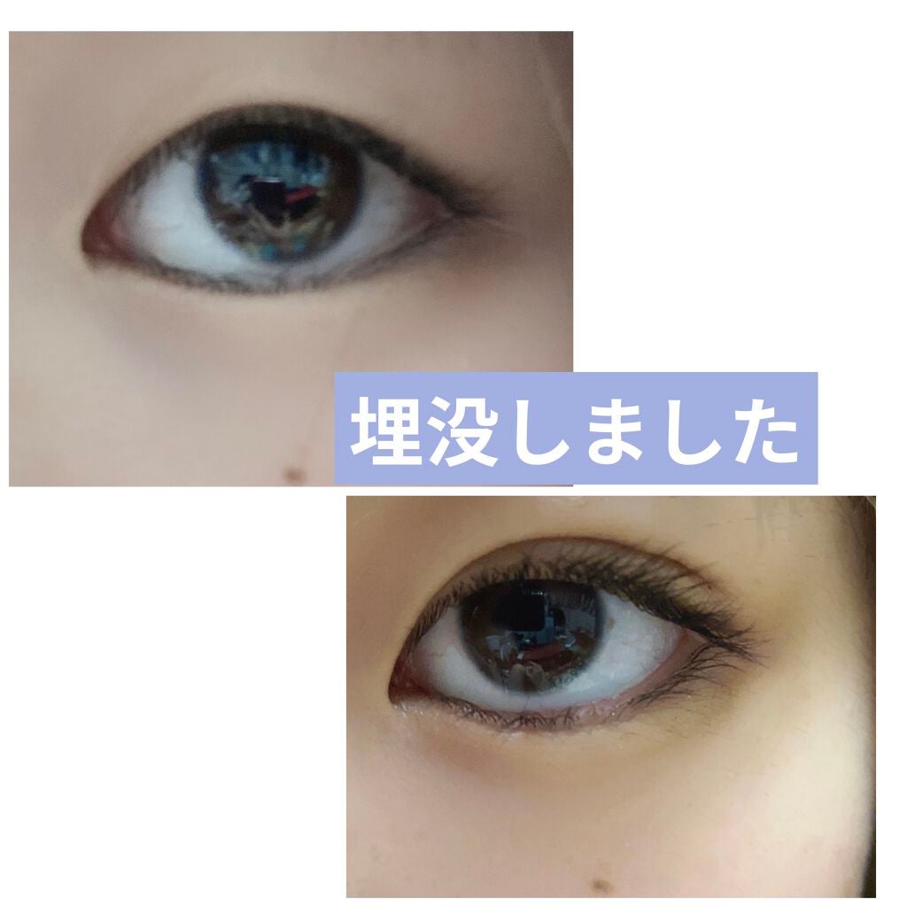 ふちこ on LIPS 「埋没してから10日経ちました。すっぴんでもずっと二重だしまつ毛..」(1枚目)