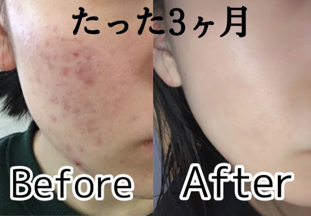 クレンジングリサーチ ウォッシュクレンジング N/クレンジングリサーチ/洗顔フォームを使ったクチコミ(1枚目)