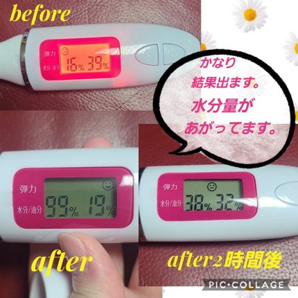 美ルル クラッシィ/belulu/美顔器・マッサージを使ったクチコミ(9枚目)