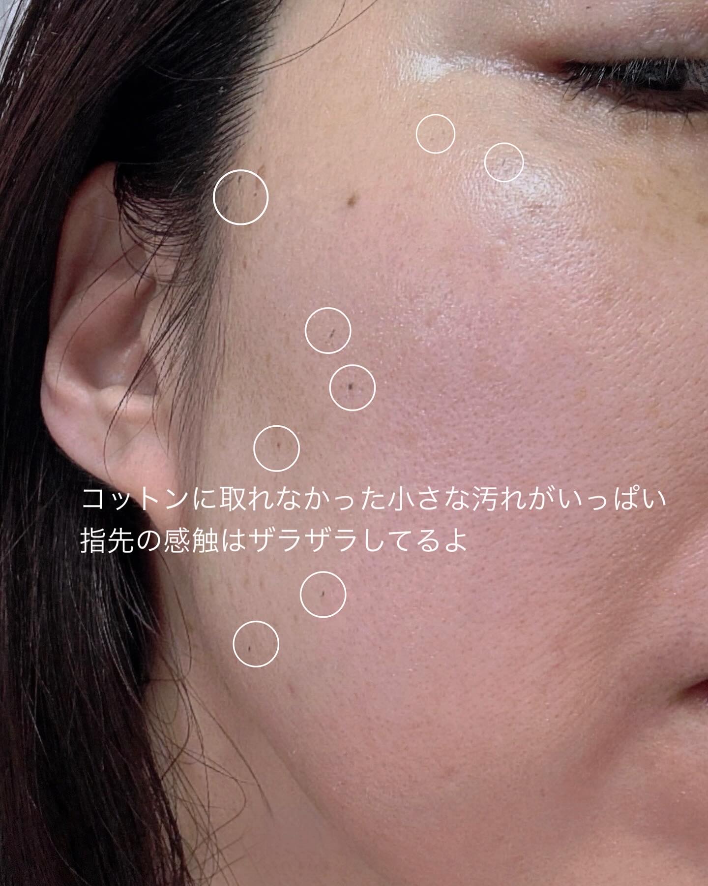 大豆エッセンス/mixsoon/美容液を使ったクチコミ（3枚目）