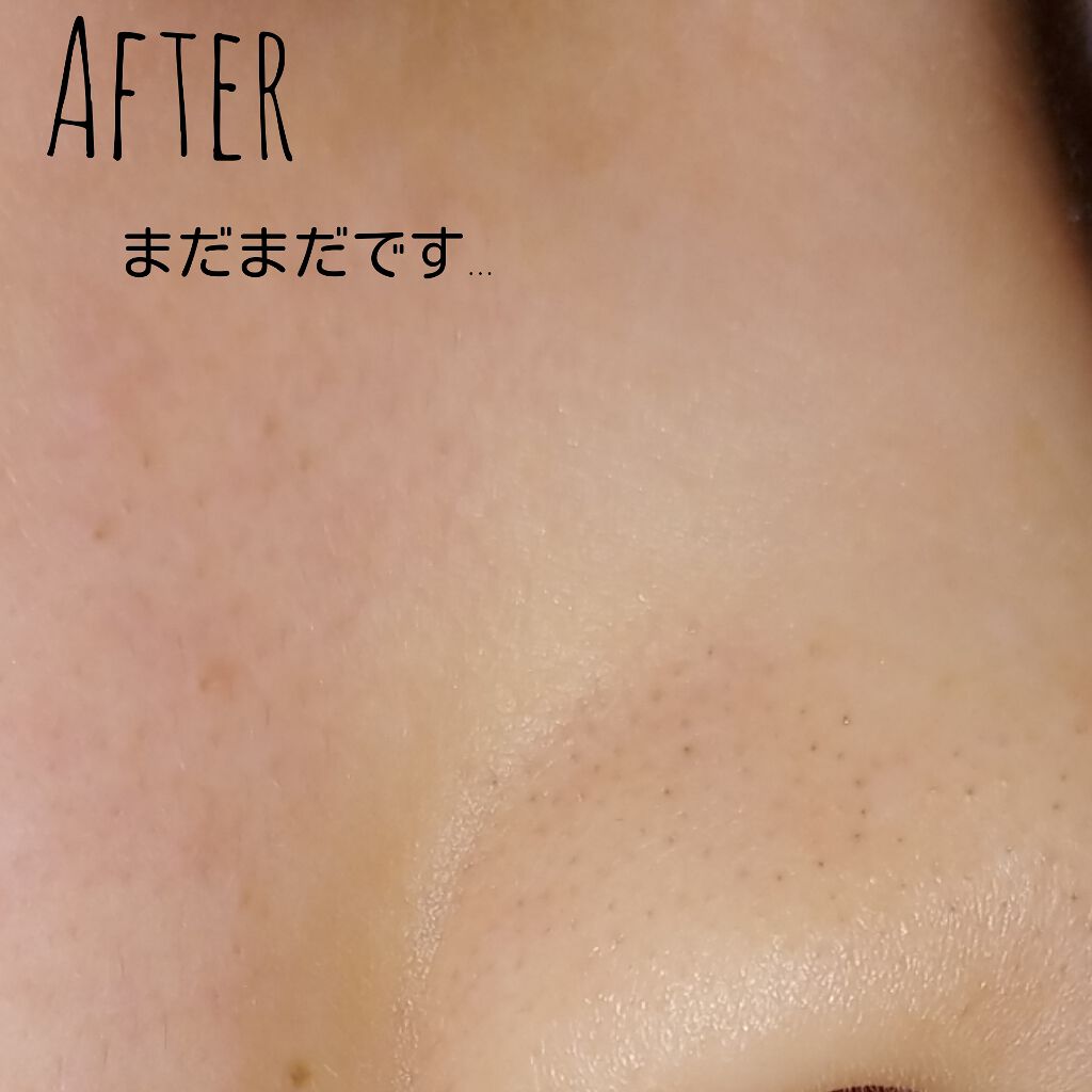 毛穴つるつるクレイパック/ボタニカルフォース/洗い流すパック・マスクを使ったクチコミ（3枚目）
