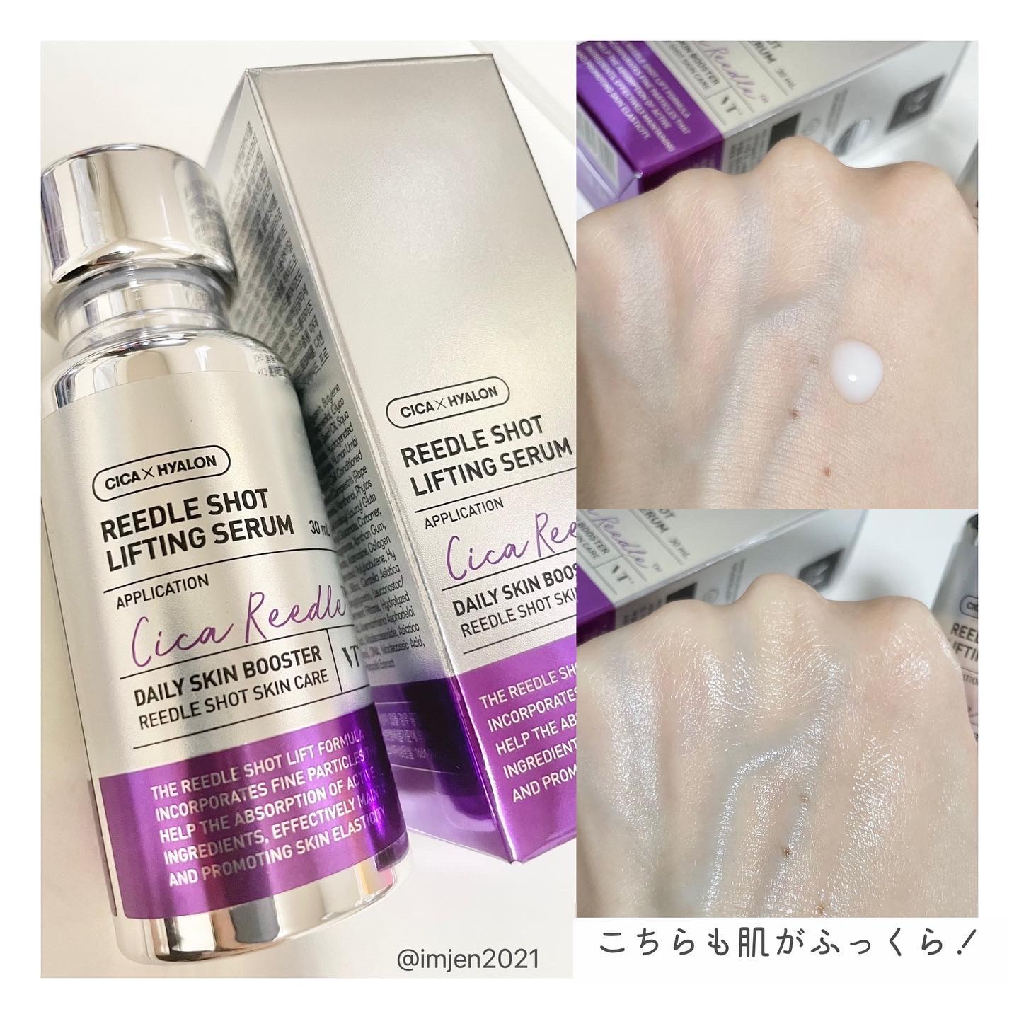 リードルショット100/VT/美容液を使ったクチコミ（3枚目）