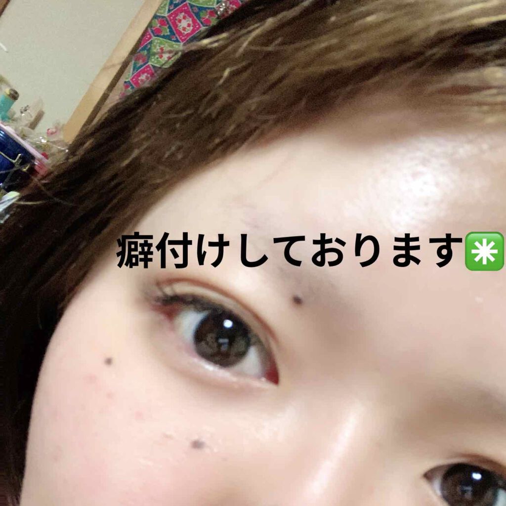 キズテープ 防水/matsukiyo/その他を使ったクチコミ（1枚目）